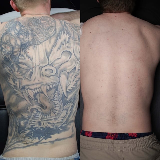 2025 2 21_12%20treatments%20on%20this%20monster